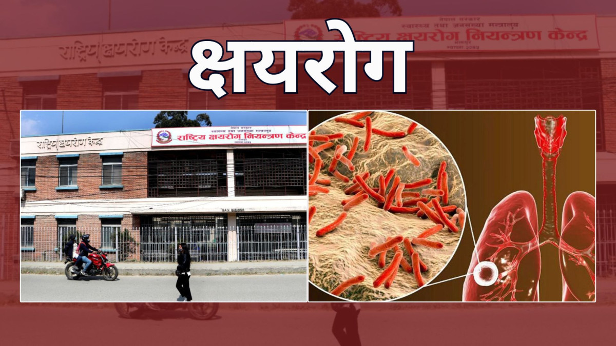 नेपालमा ६८ हजार नयाँ क्षयरोगी,२७ हजार भन्दा बढी छैनन् उपचारको पहुँचमा